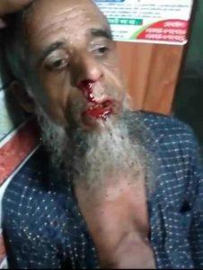 সরিষাবাড়ীতে জমি নিয়ে বিরোধ কে কেন্দ্র করে হামলা আহত-২। স্টাফ রিপোর্টার : জামালপুর জেলার সরিষাবাড়ী উপজেলার পিংনা ইউনিয়নের পিংনা দক্ষিণপাড়া গ্রামে জমি সংক্রান্ত বিরোধকে কেন্দ্র করে মারধরের ঘটনা ঘটেছে। শনিবার (১৩ সেপ্টেম্বর) সন্ধ্যা আনুমানিক ৭টা ৩০ মিনিটে এ হামলার শিকার হন স্থানীয় বাসিন্দা মোঃ মোজাম্মেল হোসেন (পিতা: মৃত দুধু শেখ) ও তার ছেলে নাজমুল হক। অভিযোগ সূত্রে জানা যায়, দীর্ঘদিন ধরে জমি নিয়ে বিরোধ চলছিল দুই পক্ষের মধ্যে। এরই জেরে ওইদিন সন্ধ্যায় মোঃ সুজাত আলী, মোঃ সুলতান মিয়া ও সোহেল গং (পিতা: হযরত আলী) অতর্কিতভাবে হামলা চালান। এতে গুরুতর আহত হন মোজাম্মেল হোসেন ও তার ছেলে। ভুক্তভোগী পরিবার জানায়, হামলার সময় মোজাম্মেল হোসেনের কাছে ৫০ হাজার টাকা ছিল। মারধরের সময় সেই টাকাও হাতিয়ে নেওয়া হয়েছে বলে তাদের অভিযোগ। এর আগে হামলার হুমকির ঘটনায় ১০ সেপ্টেম্বর ২০২৫ ইং তারিখে সরিষাবাড়ী থানায় একটি অভিযোগ দায়ের করেছিলেন মোজাম্মেল হোসেন। আহতদের উদ্ধার করে সরিষাবাড়ী উপজেলা স্বাস্থ্য কমপ্লেক্সে ভর্তি করা হয়েছে। বর্তমানে এলাকায় উত্তেজনা বিরাজ করছে। সরিষাবাড়ী থানার ভারপ্রাপ্ত কর্মকর্তা (ওসি) মোঃ রাশেদুল হাসান বলেন, “জমি নিয়ে বিরোধের জেরে হামলার অভিযোগ পাওয়া গেছে। বিষয়টি তদন্ত করে আইনগত ব্যবস্থা নেওয়া হবে।